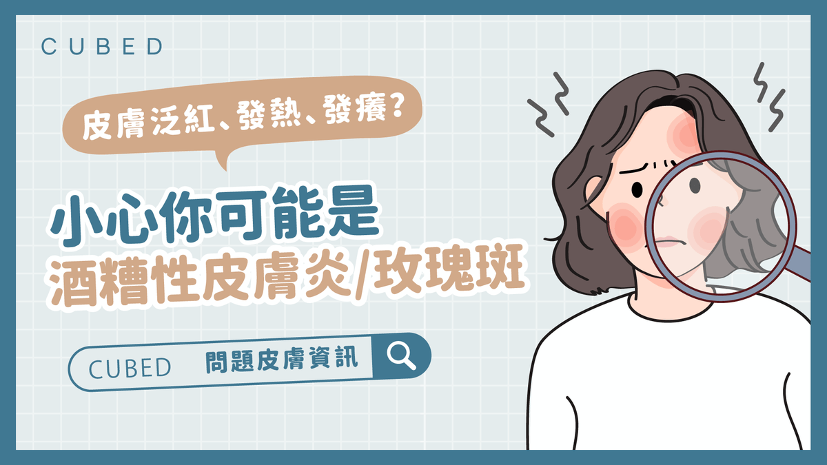 皮膚泛紅、發熱、發癢？小心你可能是酒糟性皮膚炎/玫瑰斑！ – CUBED SKINCARE