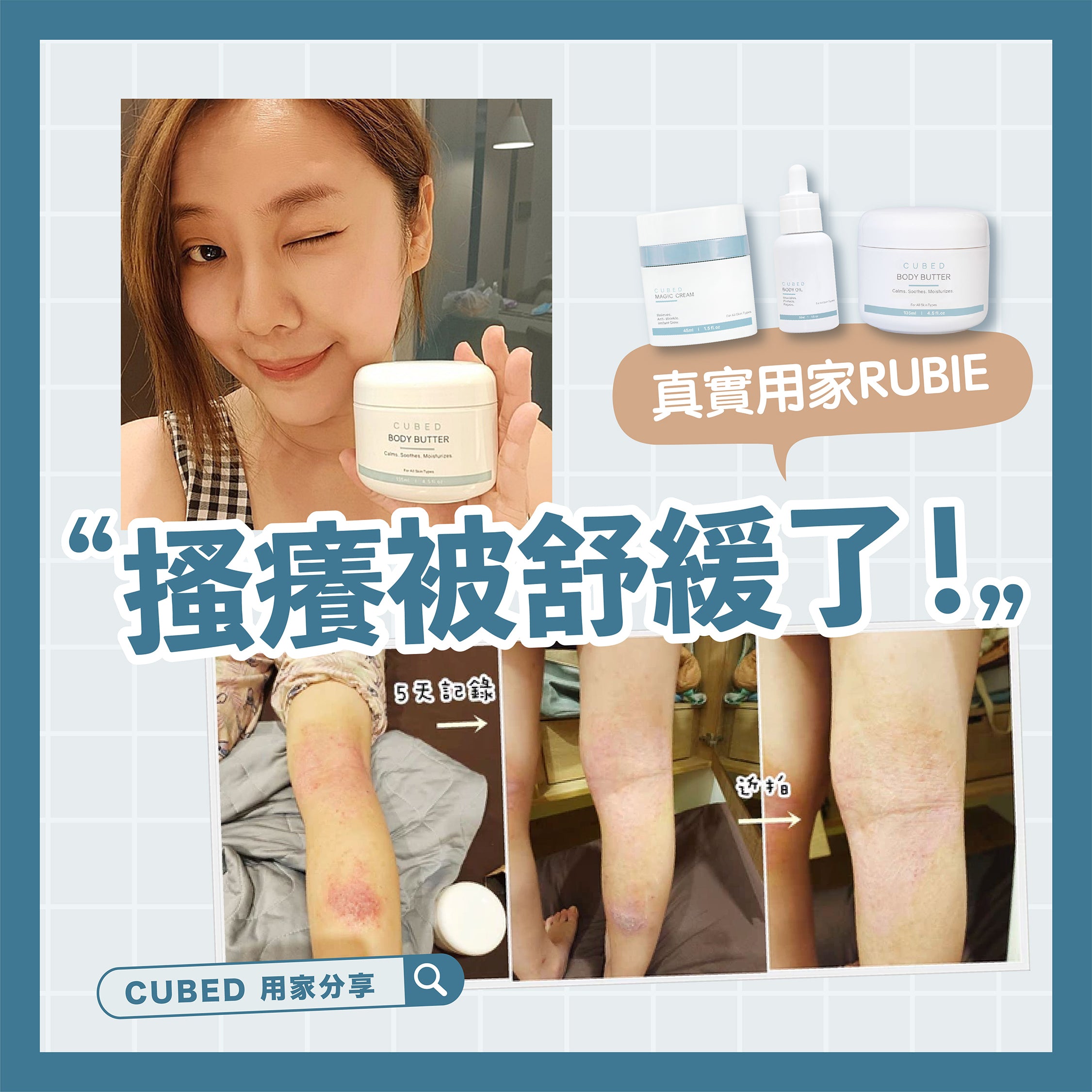 RUBIE用家分享轉載:有感的改善女兒的濕疹困擾