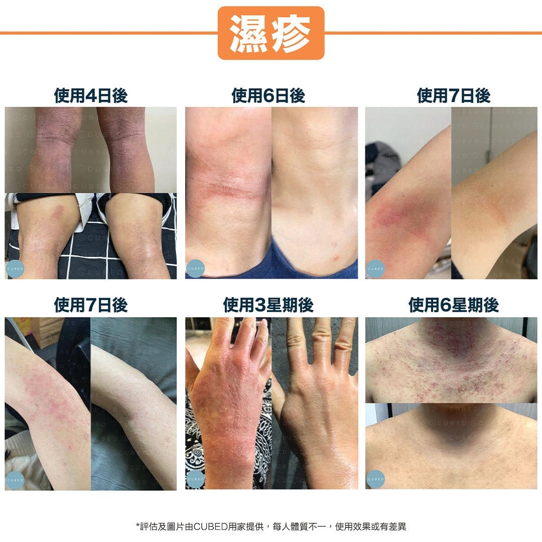 加厚極潤版低敏紓緩潤膚霜(預訂:3月頭寄出)