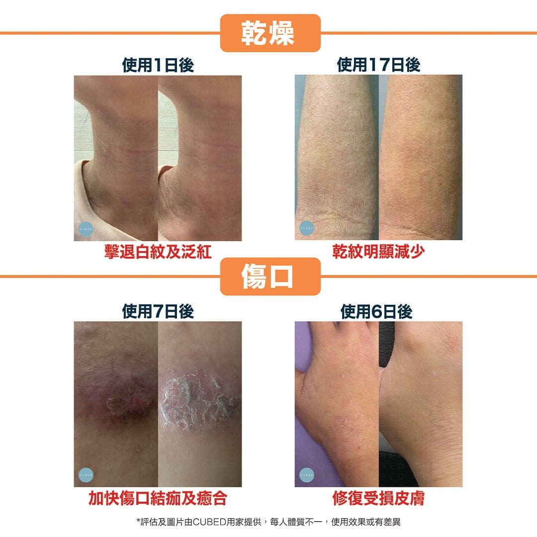 Cubed Dry Skin Therapy 乾肌修護乳液 - 日常保濕修復乾燥痕癢減淡乾紋 | 濕疹肌、敏感肌推薦 | 過千用家回圖證實