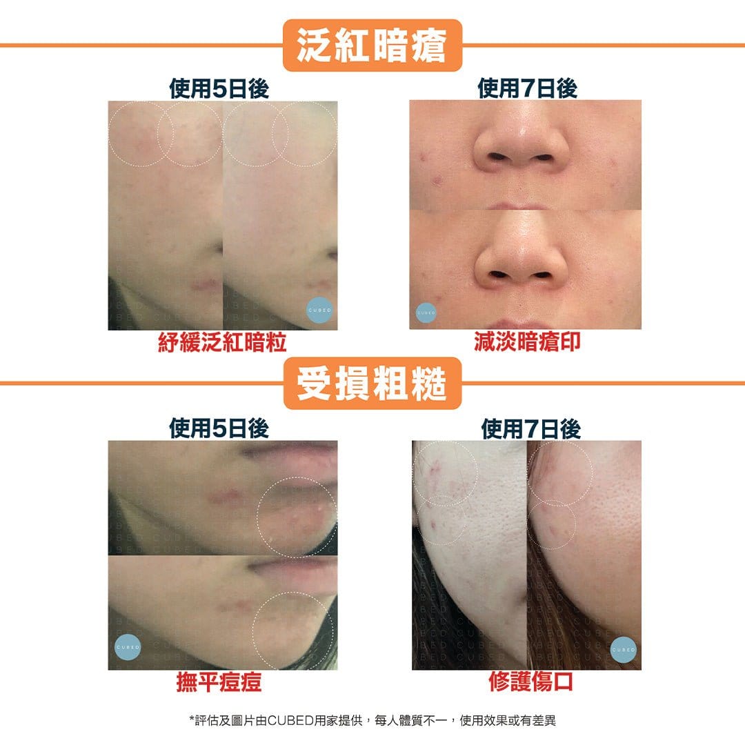 Cubed Calming Toner 低敏平衡紓緩爽膚水 - 低敏保濕紓緩缺水乾燥 | 濕疹肌、敏感肌、暗瘡肌推薦 | 過千用家回圖證實