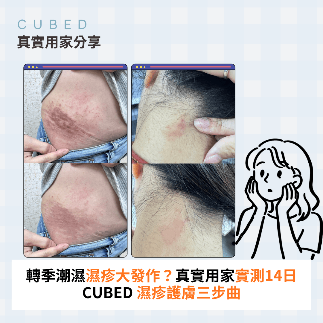 轉季潮濕濕疹大發作？真實用家實測14日 CUBED 濕疹護膚三步曲