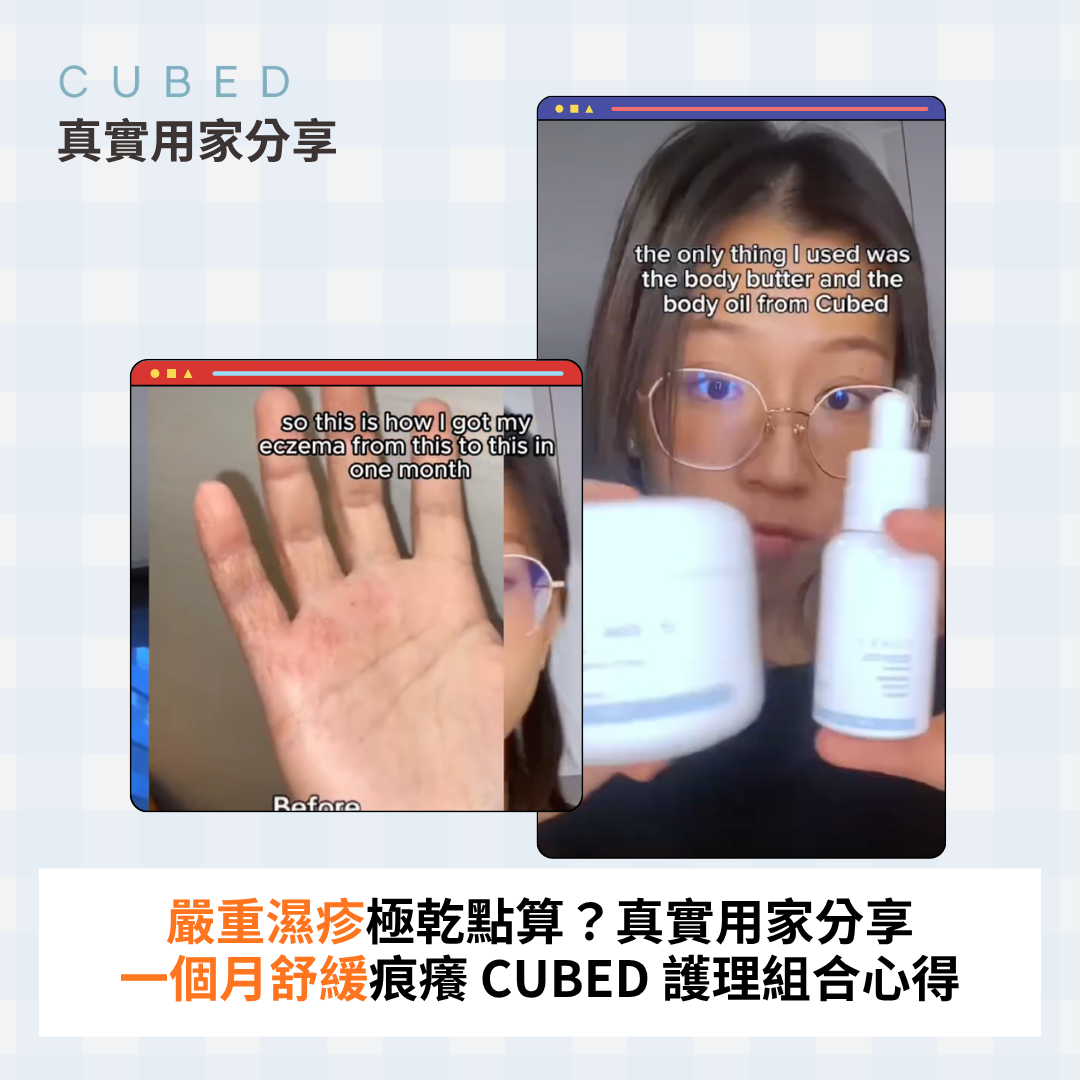 嚴重濕疹極乾點算？真實用家分享一個月舒緩痕癢 CUBED 護理組合心得