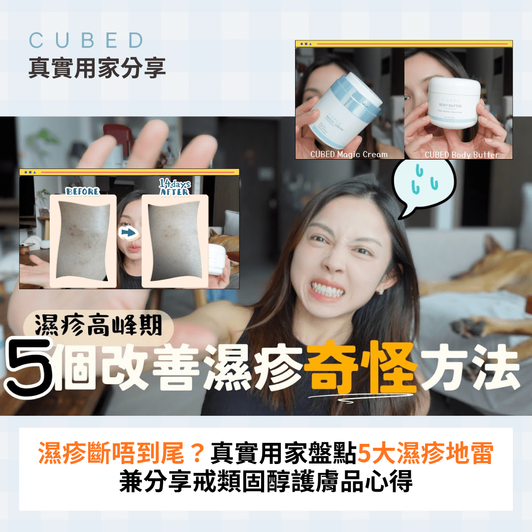 濕疹斷唔到尾？真實用家盤點5大濕疹地雷兼分享戒類固醇護膚品心得