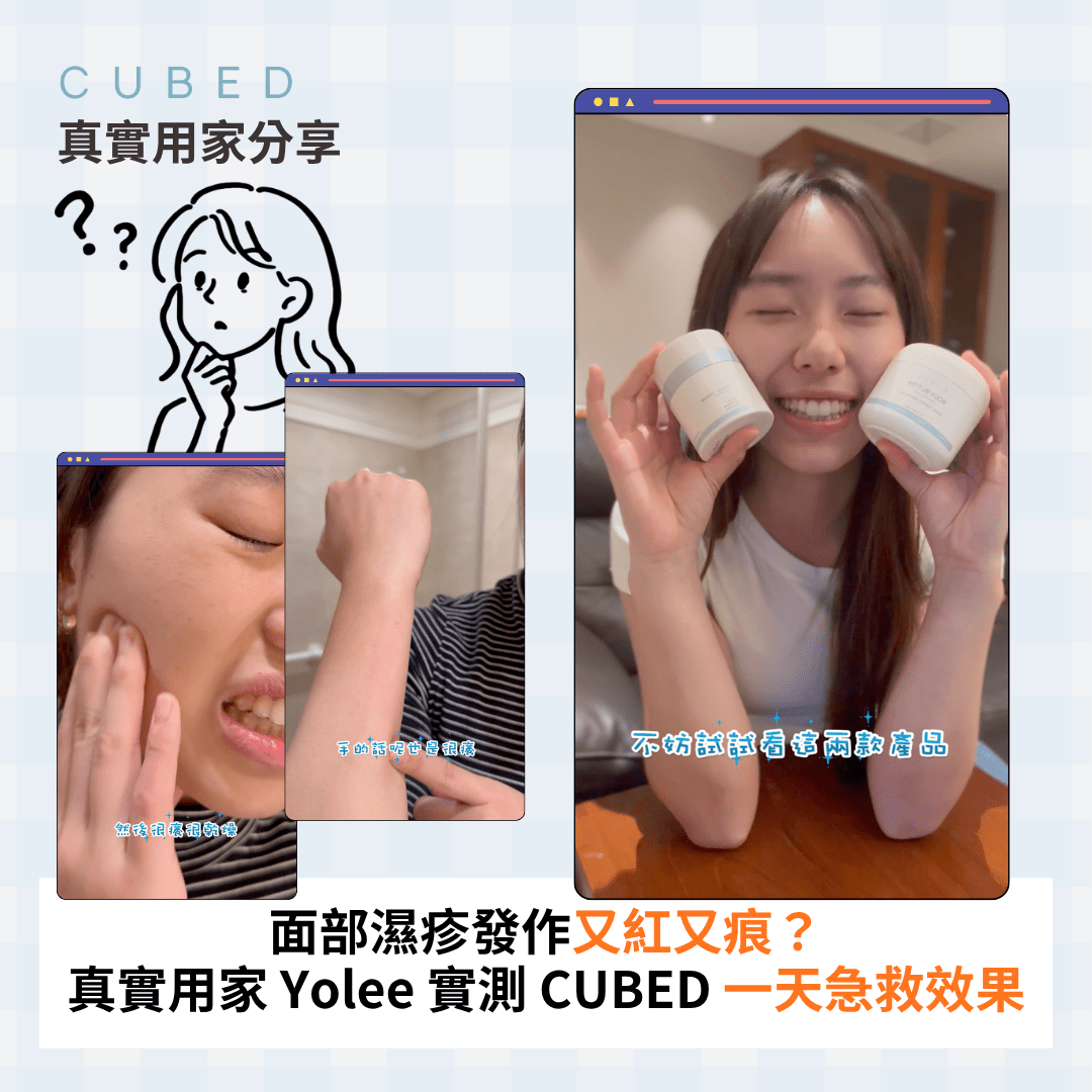 面部濕疹發作又紅又痕？真實用家 Yolee 實測 CUBED 一天急救效果