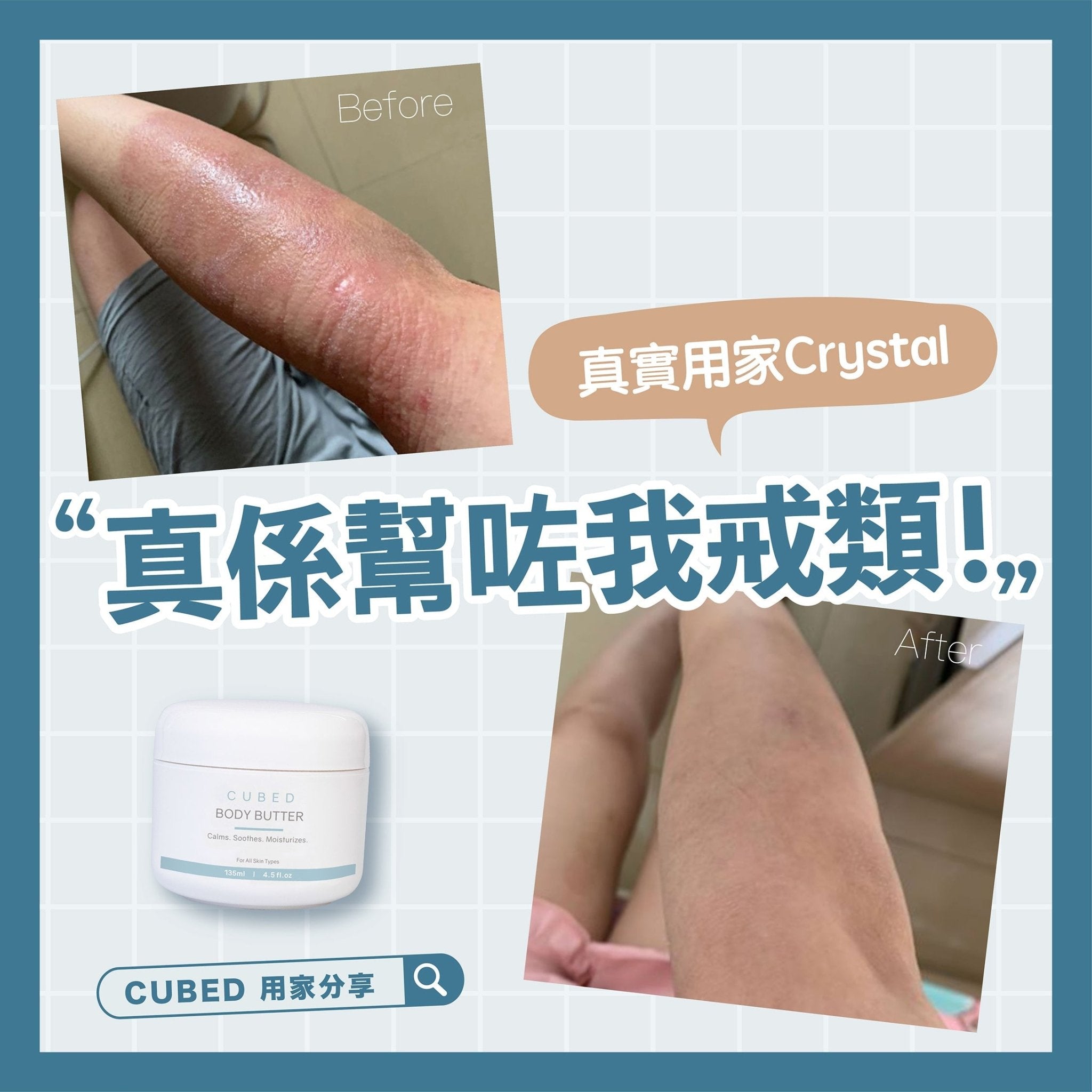 【類固醇反彈】真實用家分享：真係幫咗我戒類！