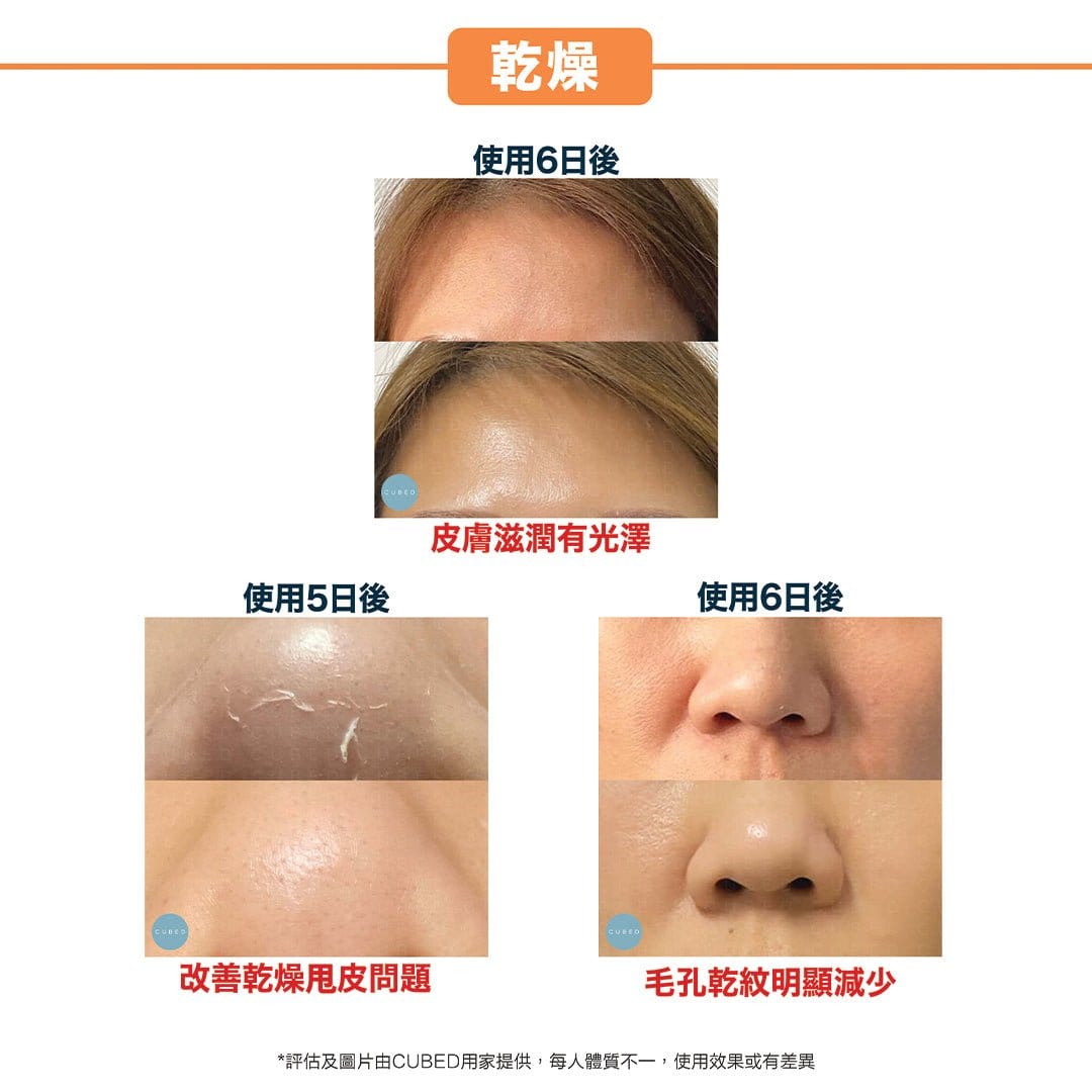 Cubed Face Oil 修復抗氧精華油 - 抗氧化抗老化減少乾紋細紋 | 濕疹肌、敏感肌推薦  | 過千用家回圖證實