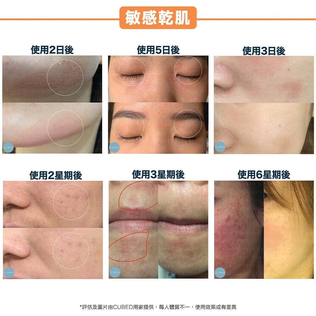 Cubed 3月限定85折優惠組合 - 修復面部乾燥痕癢、細紋色素 | 濕疹肌及乾燥肌推薦 | 過千用家回圖證實
