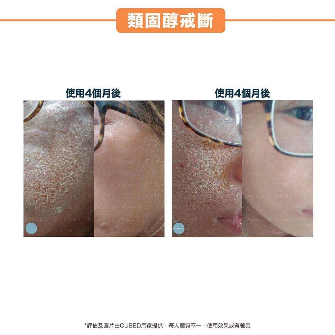 Cubed 3月限定85折優惠組合 - 修復面部乾燥痕癢、細紋色素 | 濕疹肌及乾燥肌推薦 | 過千用家回圖證實