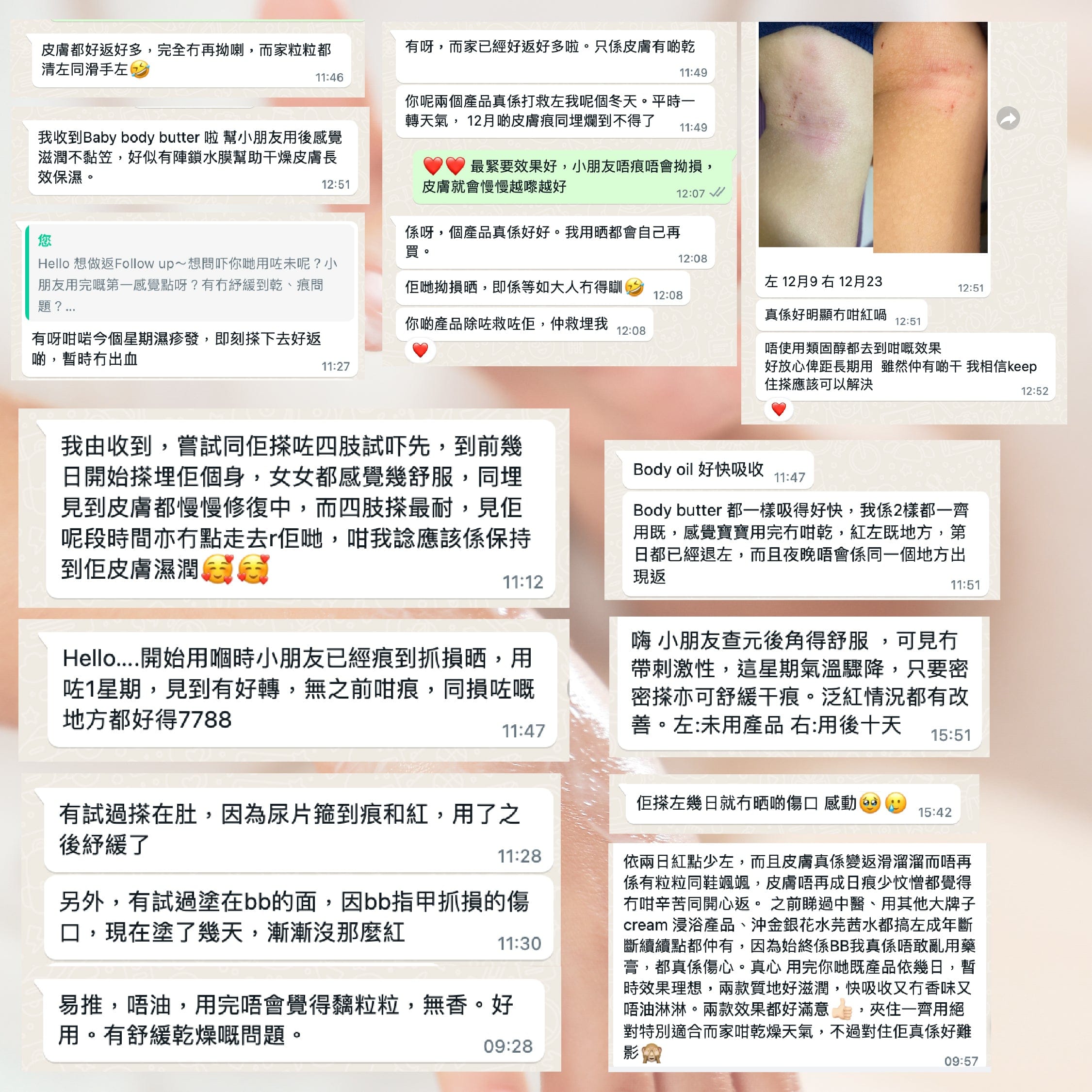 Cubed 兒童雙層修護組合 - 迅速紓緩濕疹發炎黑印紅腫紅疹及滲水傷口，更適合幼嫩脆弱皮膚使用 | 兒童濕疹肌、類固醇戒斷推薦 | 用家回圖證實